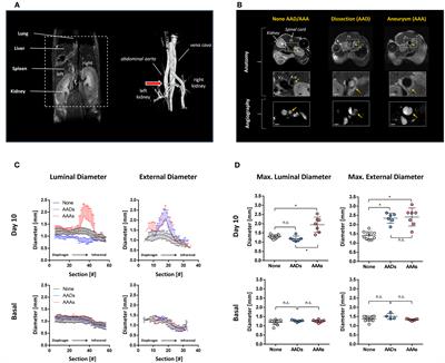 Beyond Vessel Diameters: Non-invasive Monitoring of Flow Patterns and Immune Cell Recruitment in Murine Abdominal Aortic Disorders by Multiparametric MRI